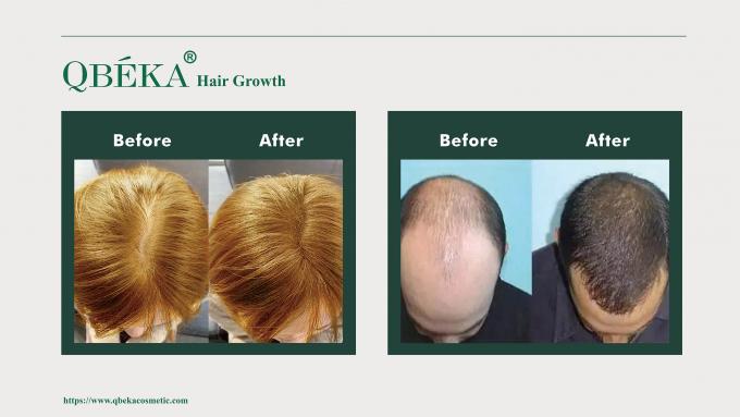 GMPC Standard Shampoo για την πρόληψη της τριχόπτωσης για την αντιμετώπιση της τριχόπτωσης και της αραίωσης 80m 10