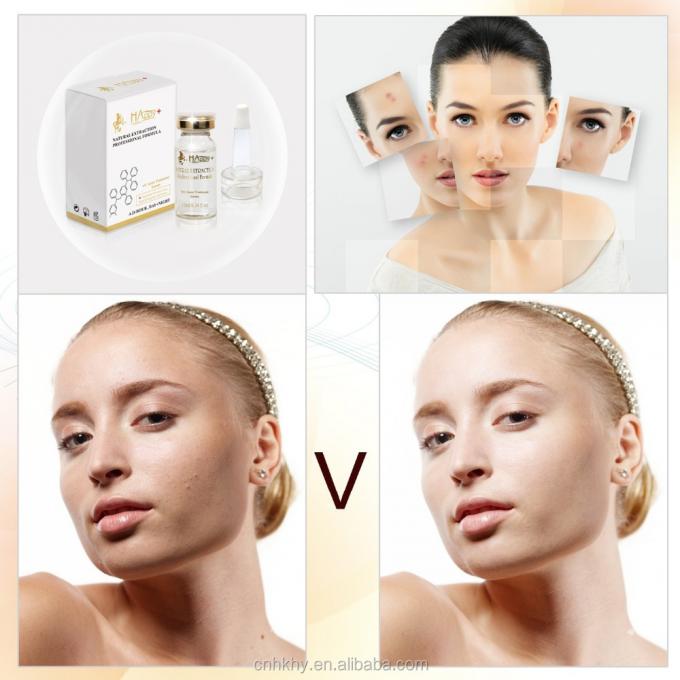 Αφαιρέστε τις ουλές ακμής με το QBEKA Happy Cosmetics Levorotatory VC Original Liquid Bio Serum 0